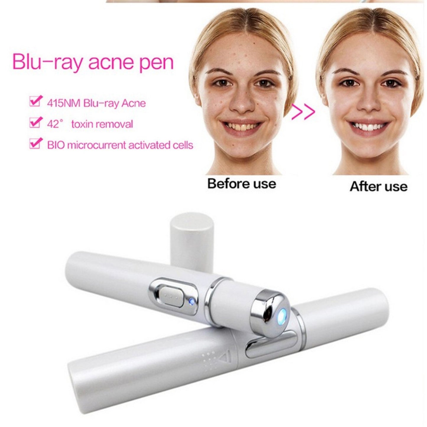 Wrinkles, blemishes, pores, acne scar removal pen