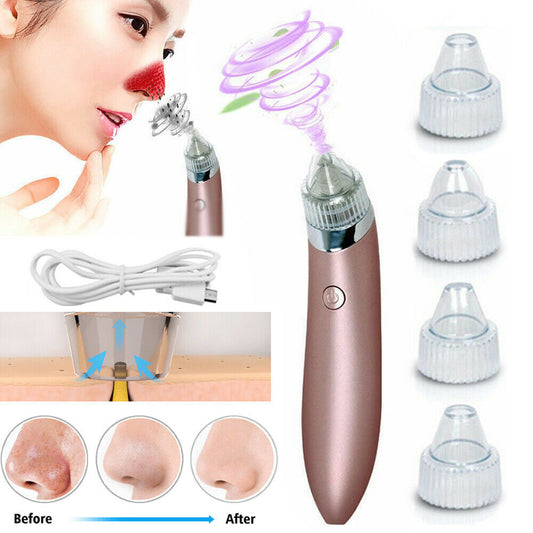 Electric Blackhead Vacuum Pore Cleaner